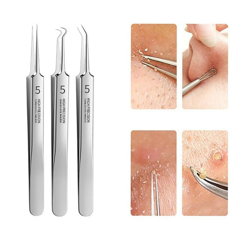 German Ultra-fine No. 5 Cell Pimples Blackhead Clip Tweezers Beauty Salon Special Scraping &amp; Closing Artifact Acne Needle Tools